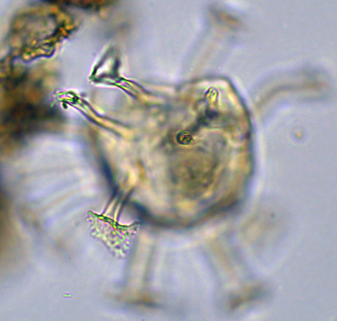 Hystrichosphaeridium tubiferum Htru27X2022150995.jpg